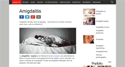 Desktop Screenshot of amigdalitis.info